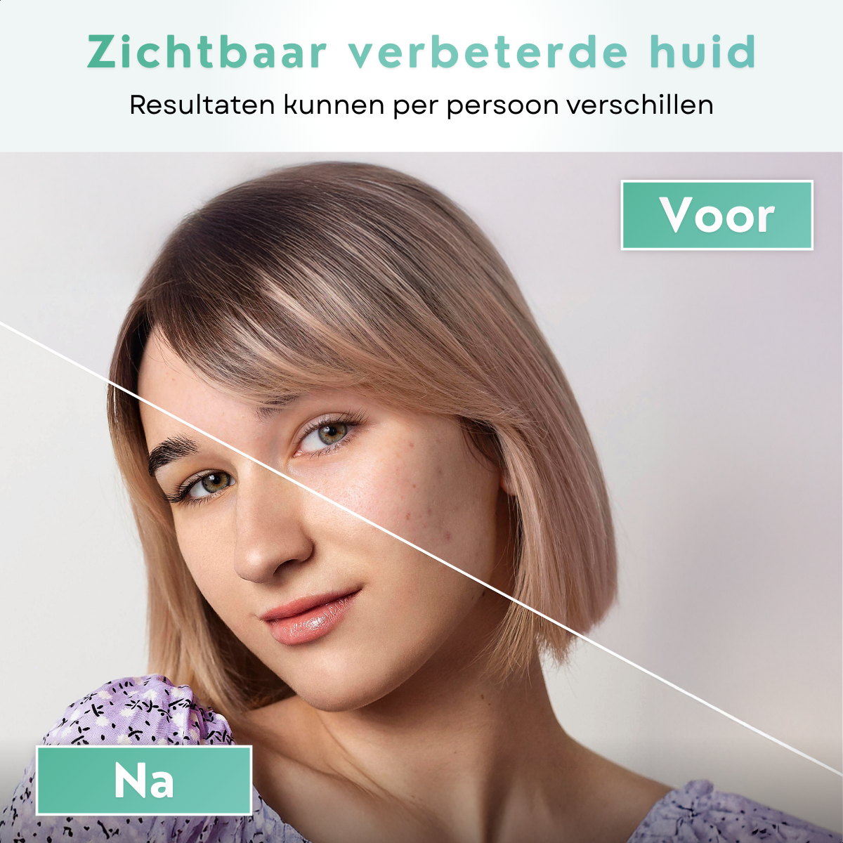 Voor- en na-afbeelding van een gezicht met zichtbare huidverbetering na gebruik van een gezichtsmasker.