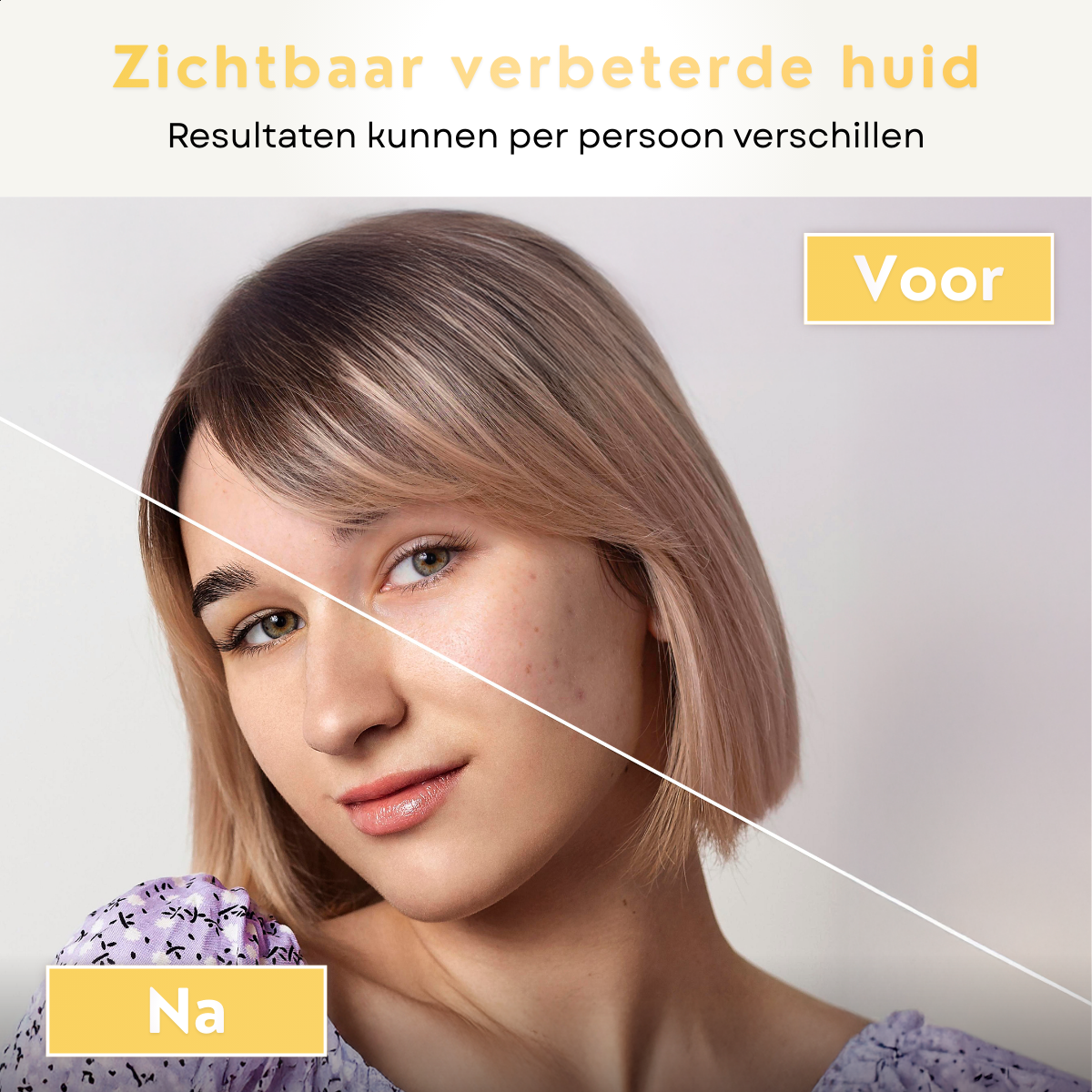 Voor en na resultaat van het Comformidable Collagen Glow Boost Mask waarbij de huid egaler en stralender oogt na gebruik